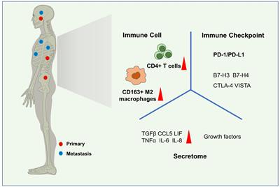 Immune microenvironment and immunotherapy for chordoma